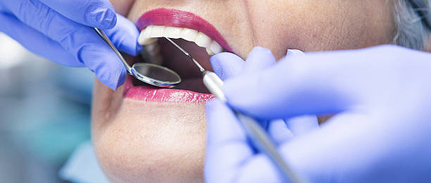 Best Emergency Dental Extractions in Kent, WA